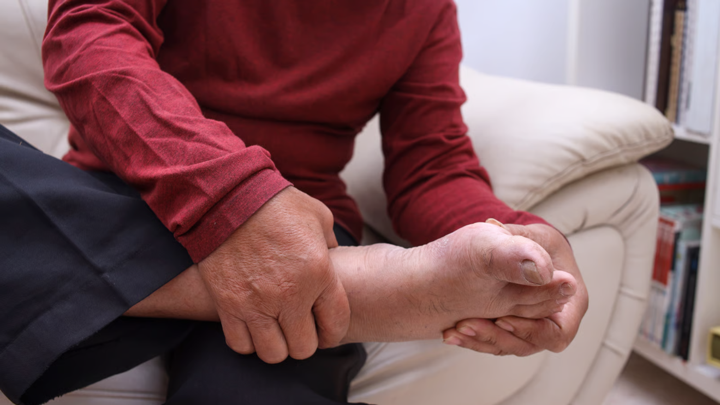 Neuropatía diabética: cuando los pies dejan de avisar