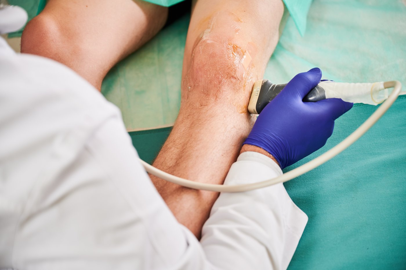 Médico realiza un ultrasonido diagnóstico de la pierna a un paciente