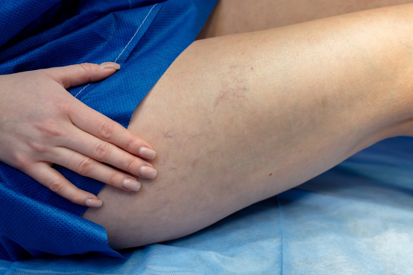 Exploración de la pierna para evaluar las venas en consulta vascular