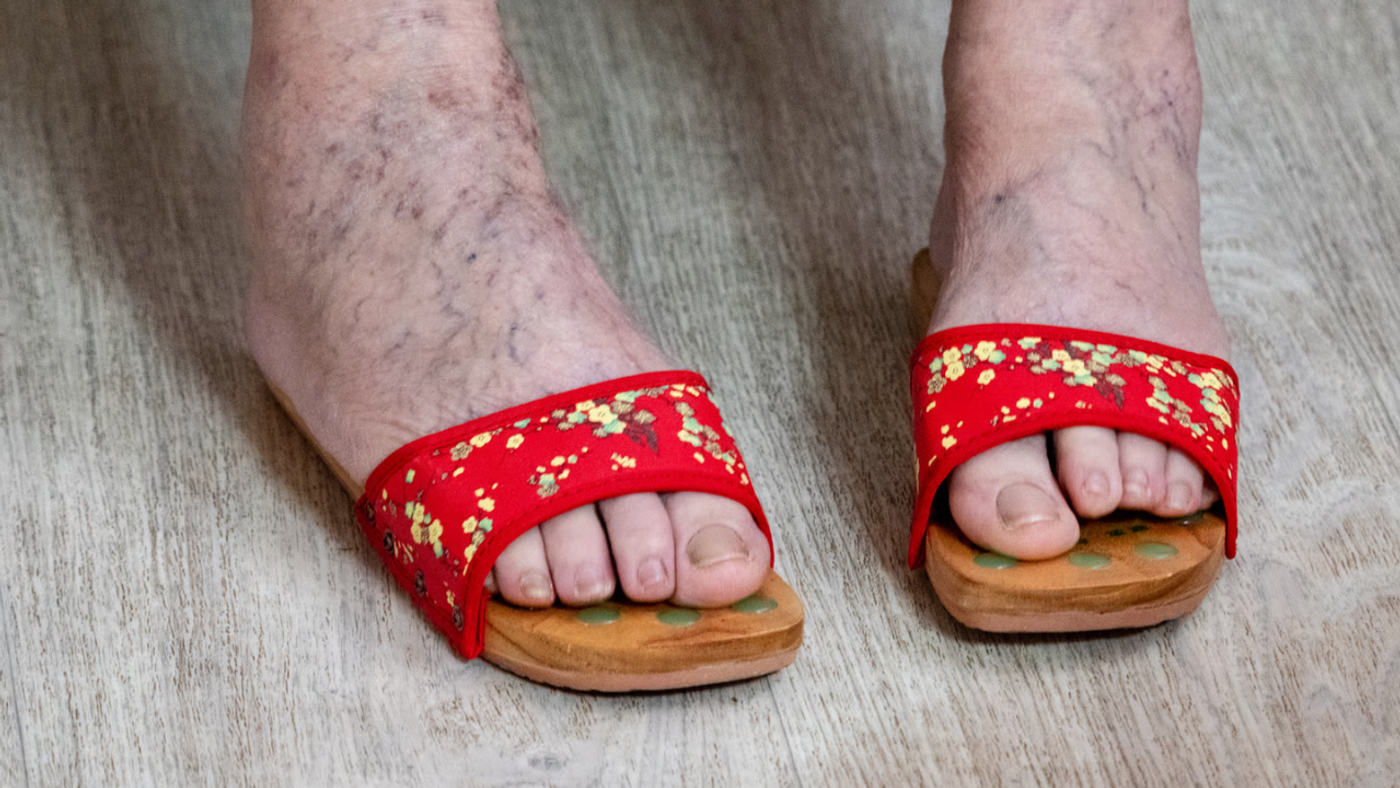 ¿Por qué se hinchan los pies en el avión y cómo evitarlo?