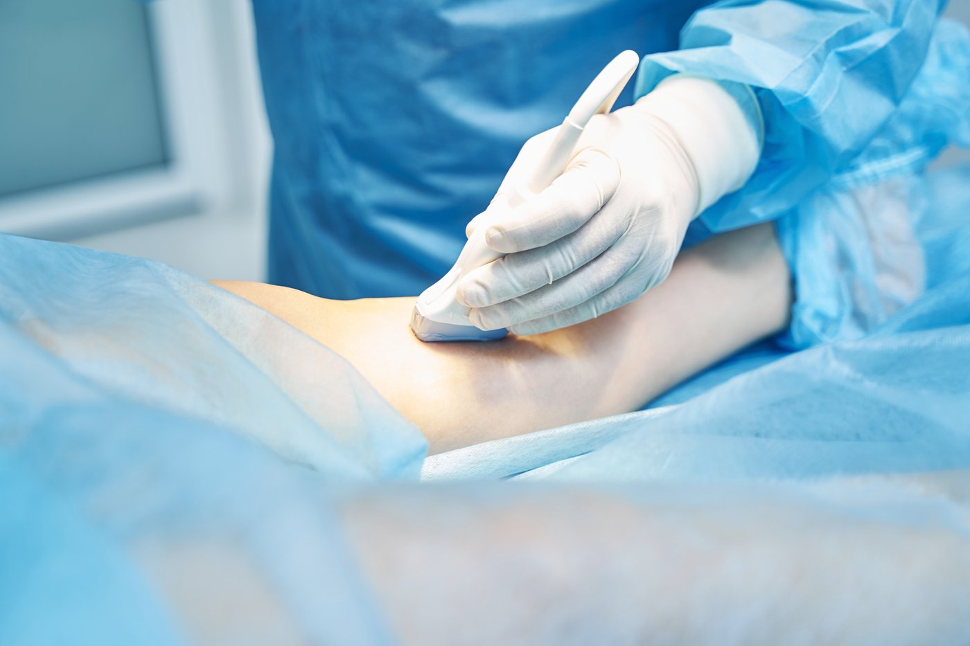 Ultrasonido de la pierna para descartar trombosis durante la consulta vascular