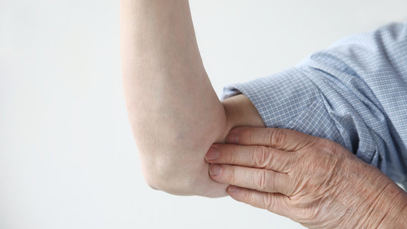 ¿Trombosis en el brazo? Sí existe: causas y señales