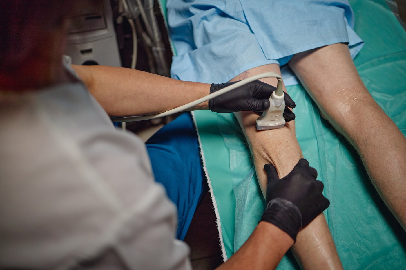 Estudio de la circulación de la pierna con ultrasonido vascular