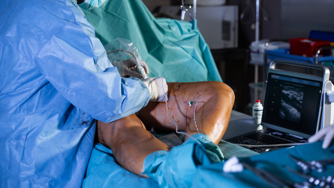 ¿Cuánto tarda una sesión de escleroterapia y cómo es el proceso?
