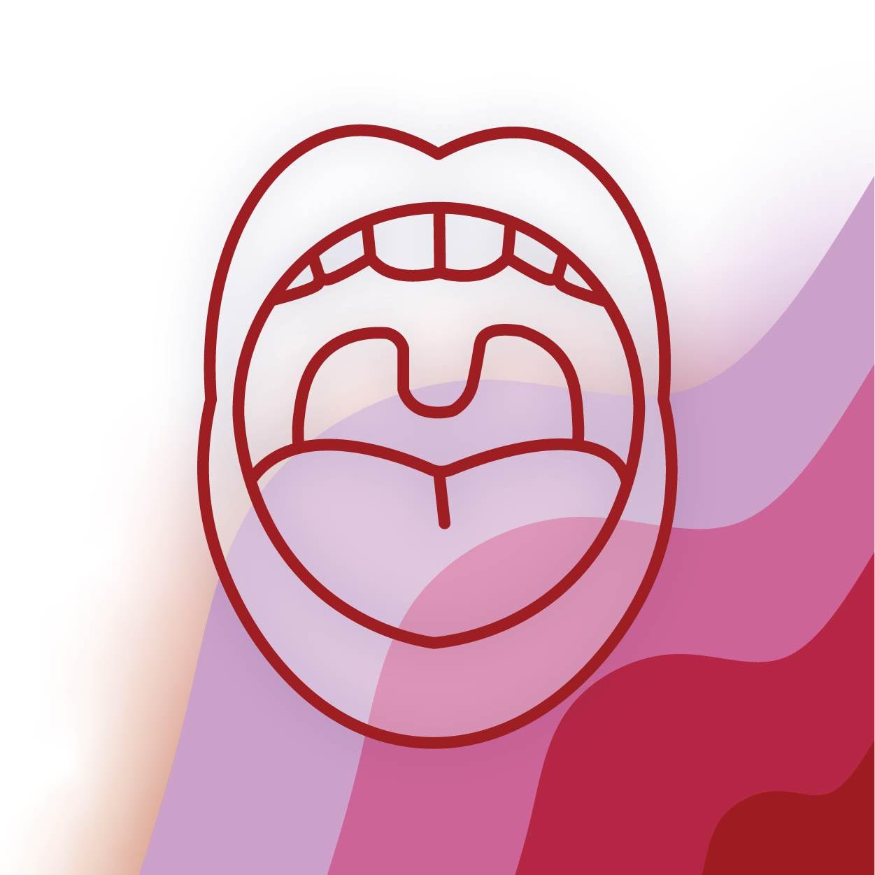 Tonsilitis