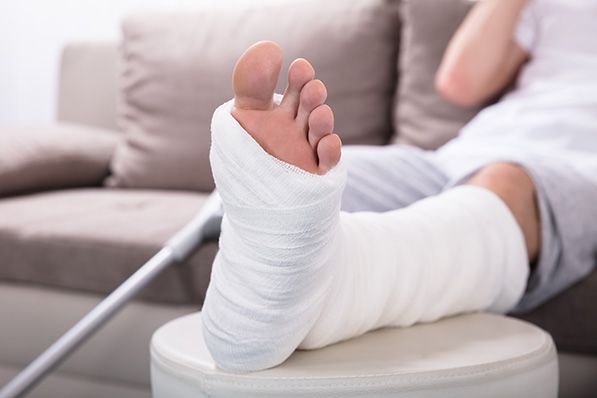 A person rests a bandaged lower leg and foot on a stool beside crutches.