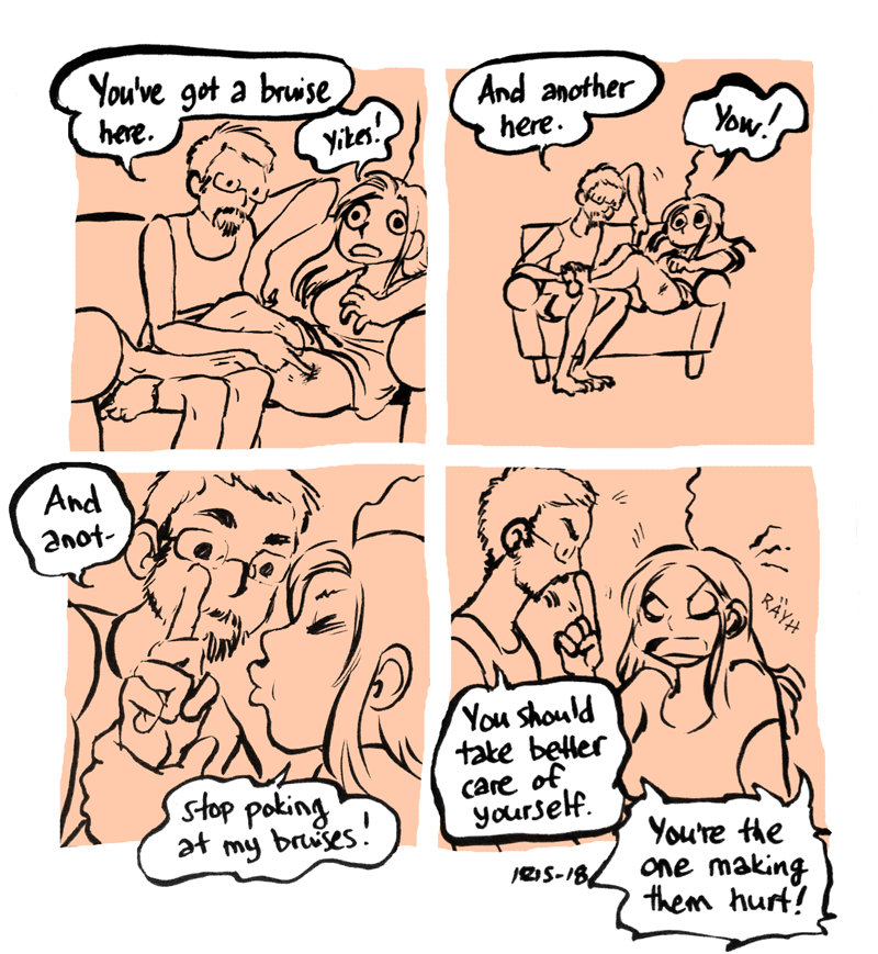 bruises