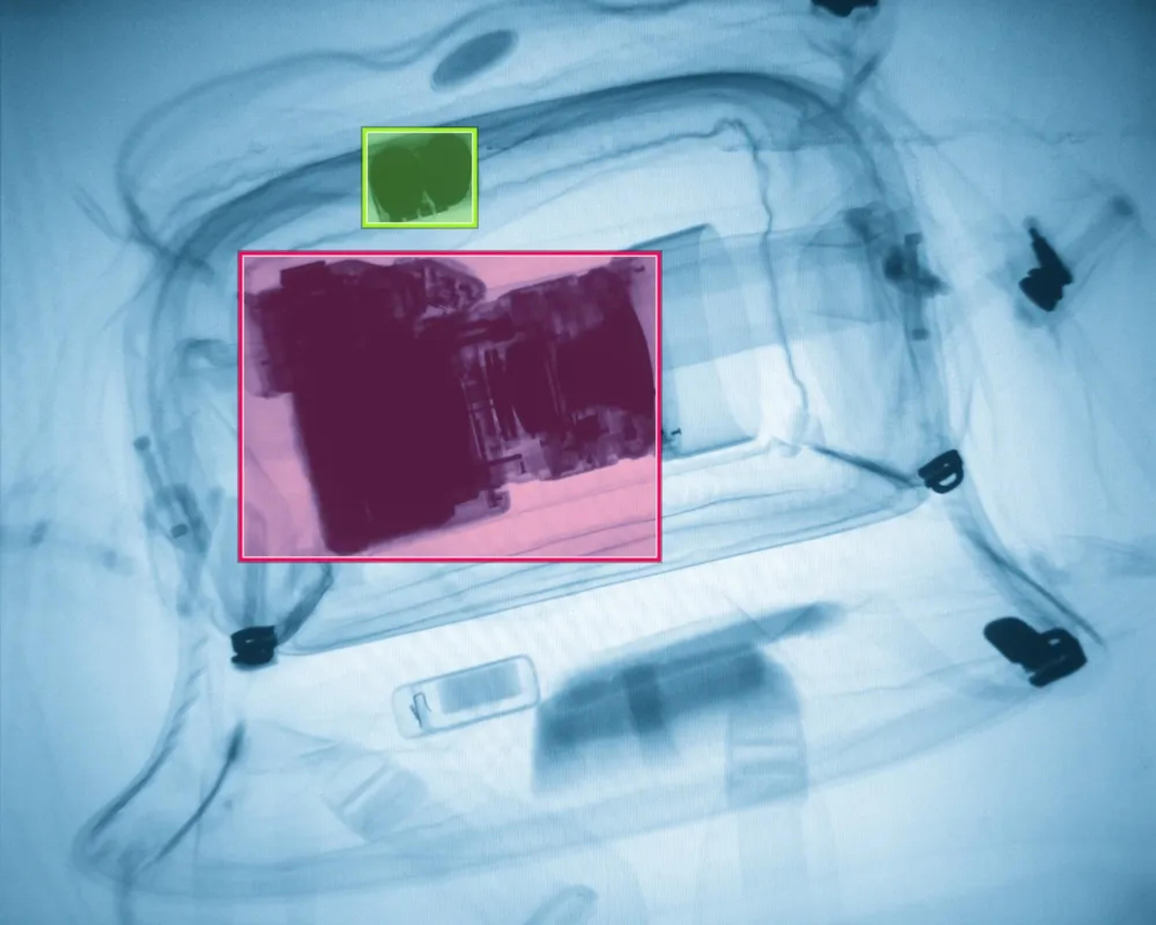 X-ray screening