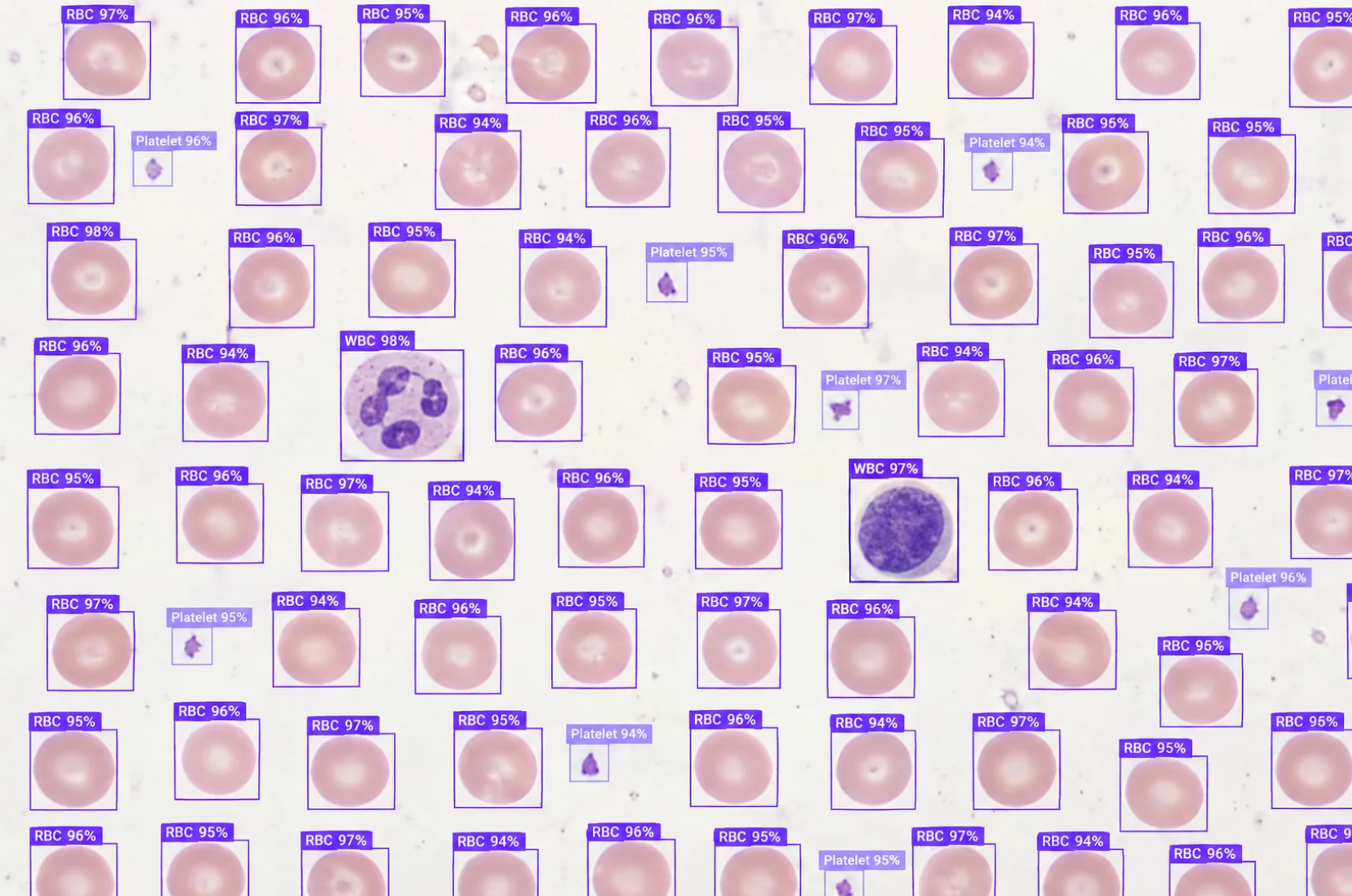 Microscopic image of blood cells with AI detection boxes identifying Red Blood Cells, White Blood Cells, and Platelets with confidence scores.