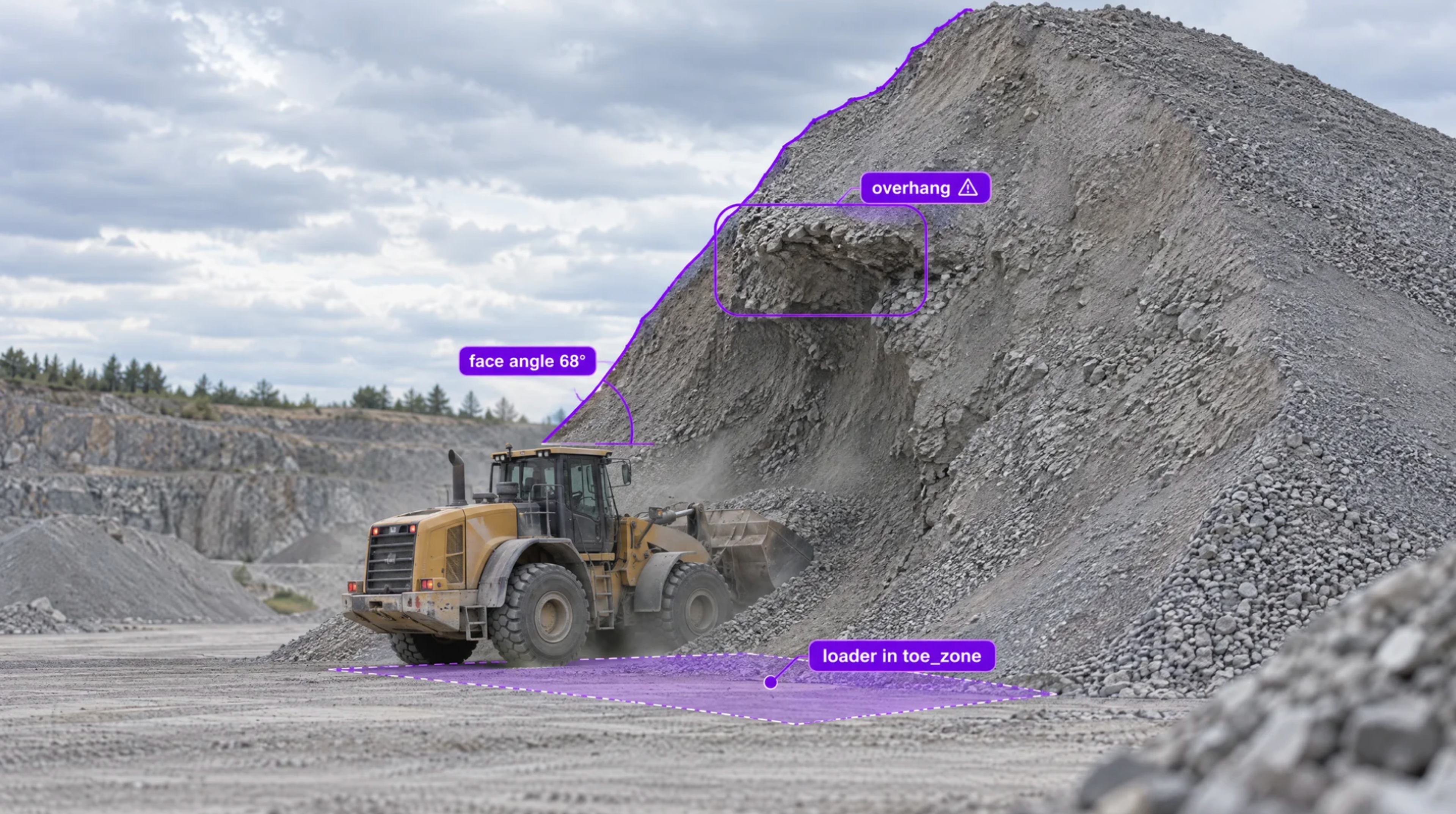 Aggregate stockpile with a loader at an undercut toe, the overhang and toe zone outlined in purple