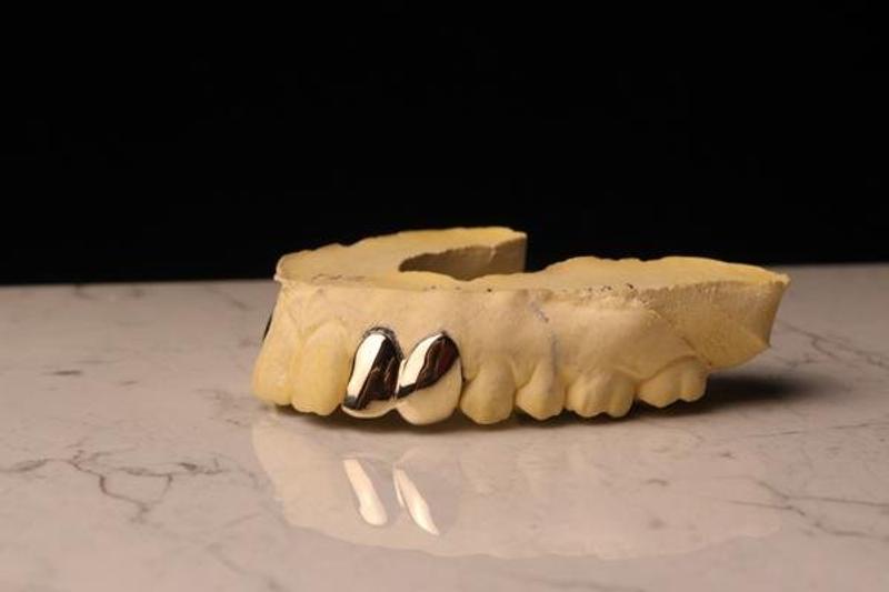 Silver 3-Tooth Open-Face Fang Top Grillz