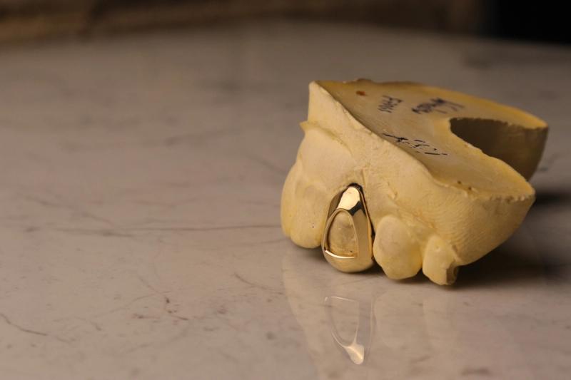 Gold Single-Tooth Canine Grill