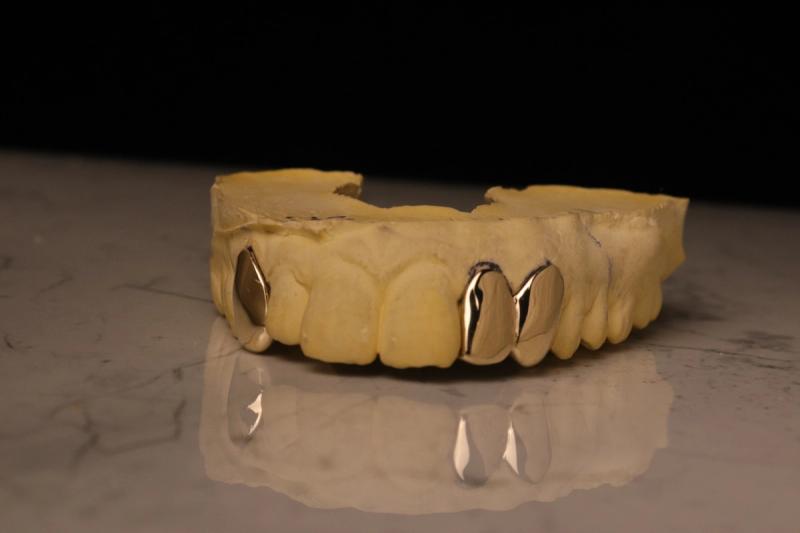 Gold Open-Face Fang Grillz Set