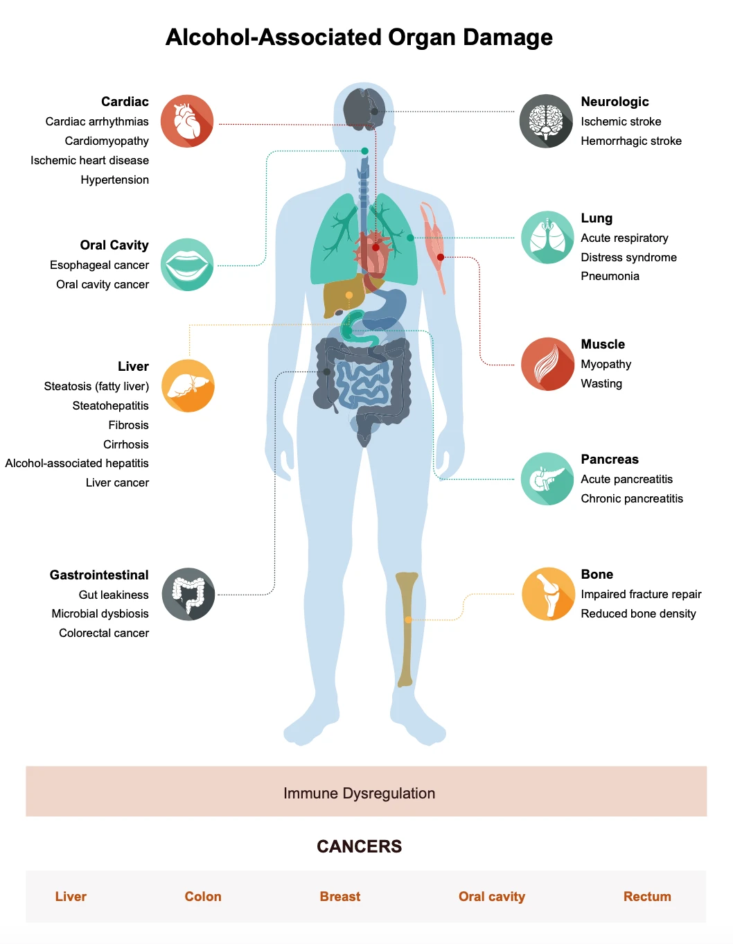 A chart of the human body which indicates what parts of the body is negatively impacted by alcohol consumption. 