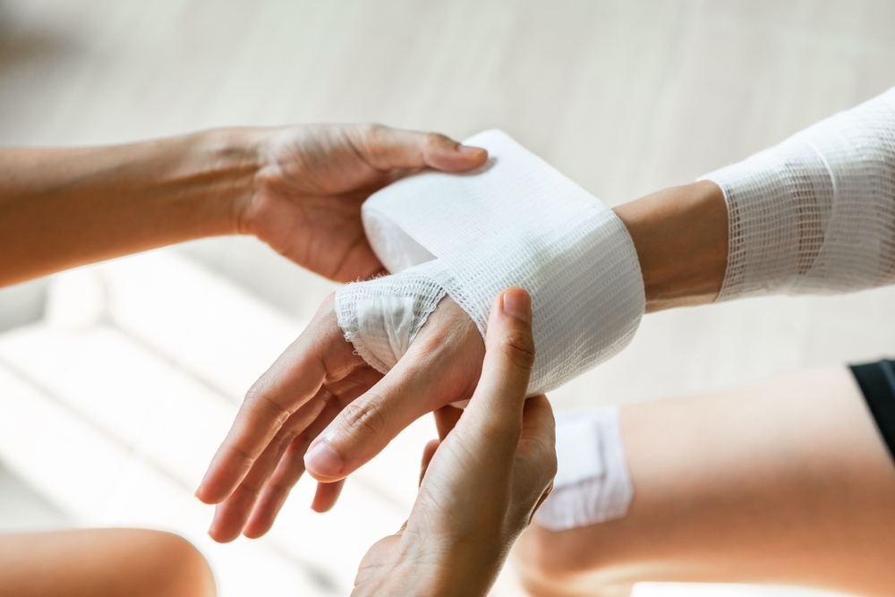 Image Person wrapping a bandage around an injured hand, representing severe burn injury treatment and recovery in Philadelphia.
