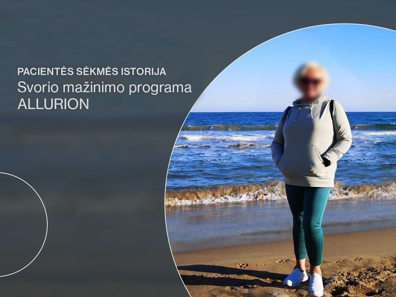 Programa ALLURION ir 22 kg sumažėjęs svoris: pacientės sėkmės istorija