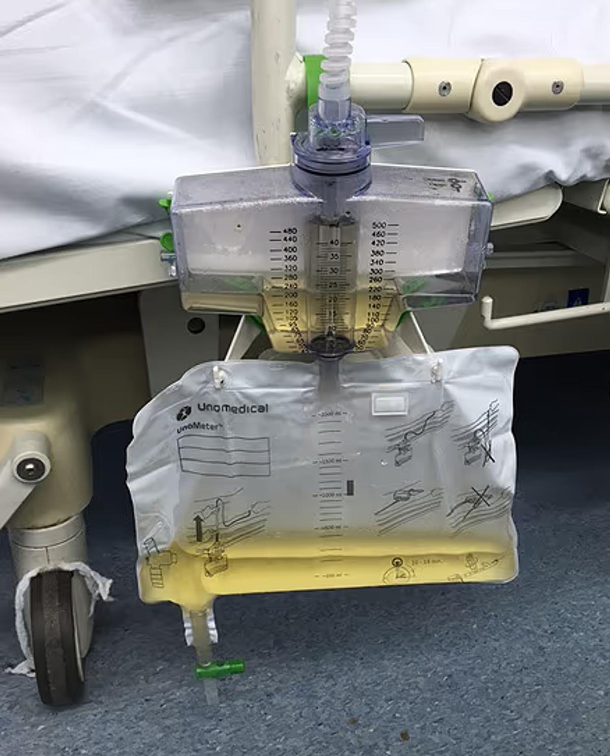 Catheter urine bag