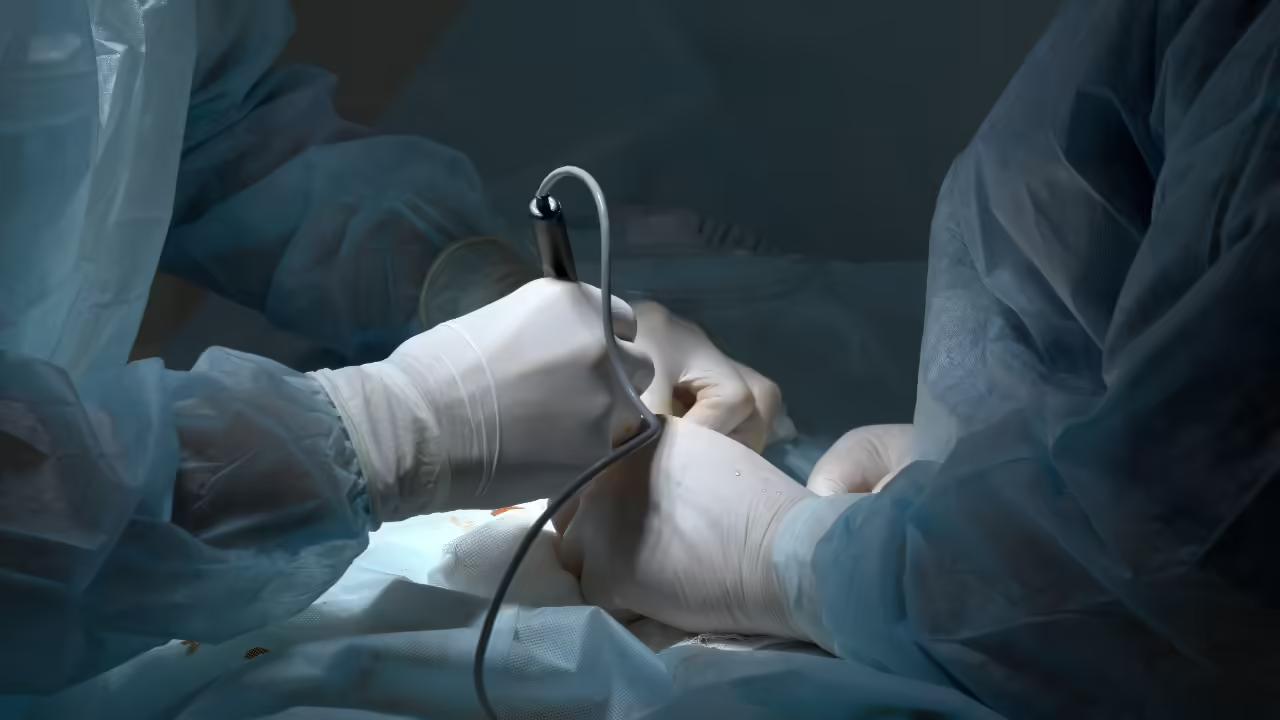 Gloved surgeons’ hands guiding a keyhole surgical instrument over a draped patient under theatre lights