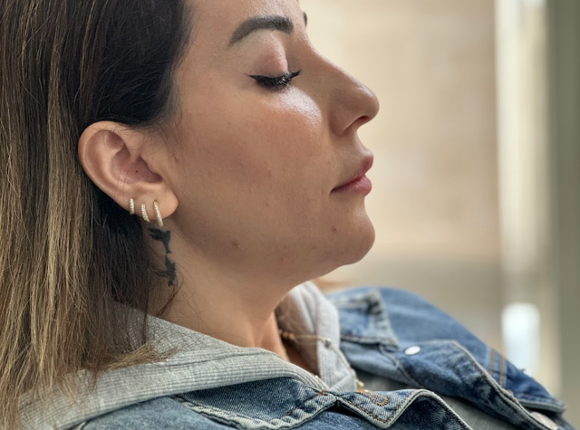 side profile of a woman's face before a Jawline filler treatment in Ajax