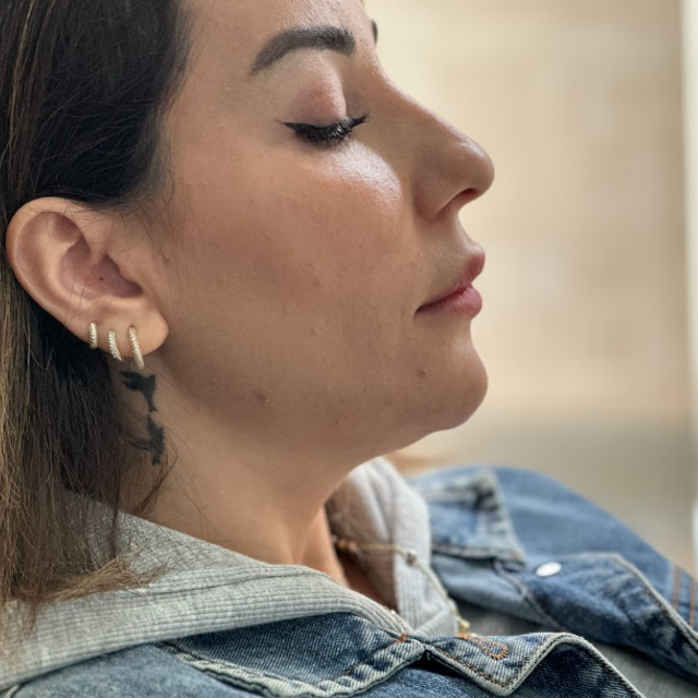 side profile of a woman's face before a Jawline filler treatment in Ajax