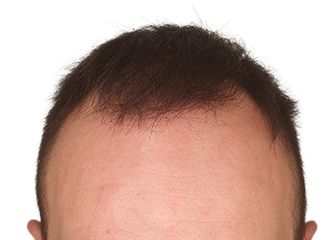 Image one