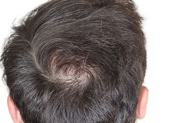 Image two