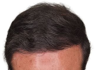 Image two