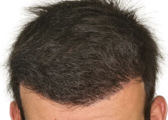 Image two