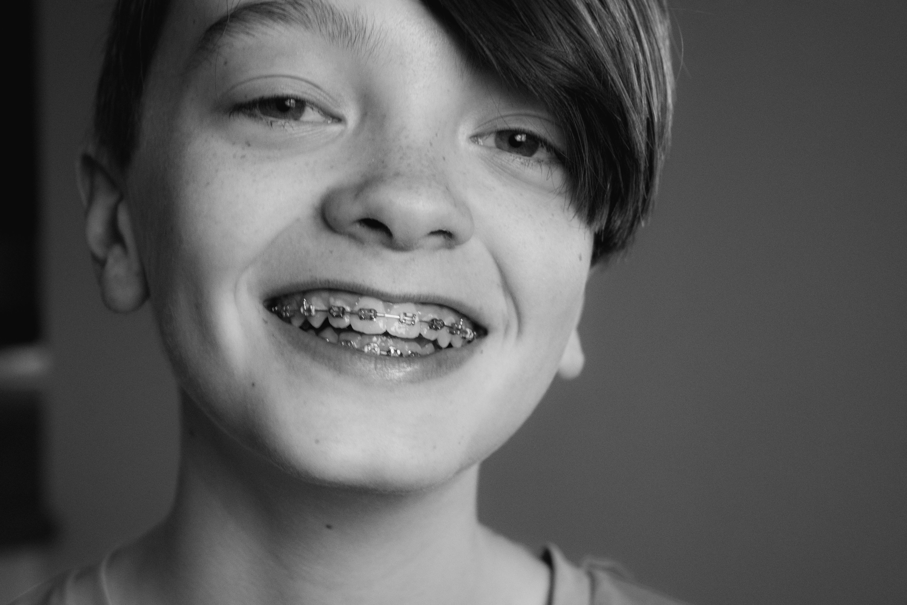 a young boy with braces on his teeth is smiling in a black and white photo .