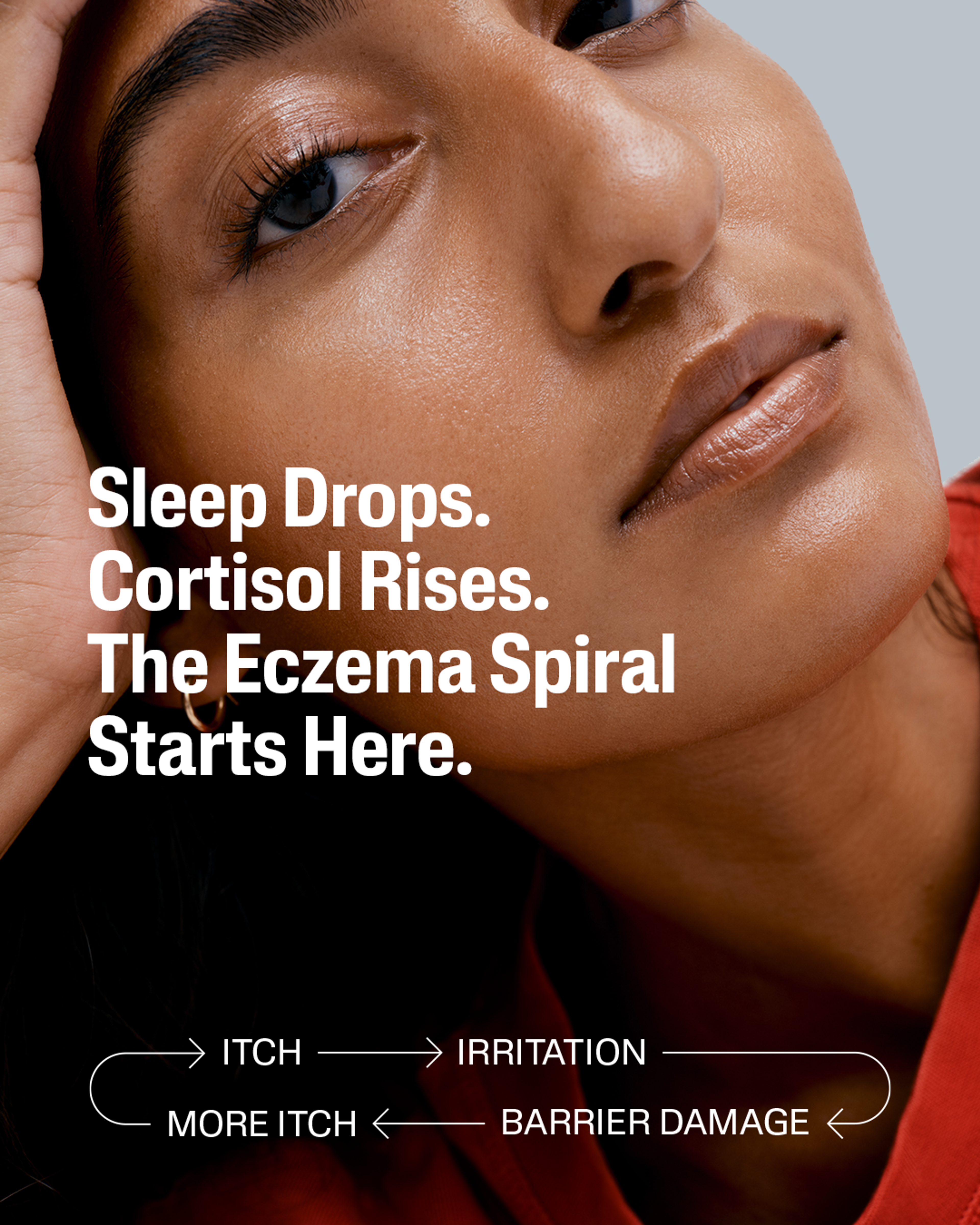 Modern Life Eczema