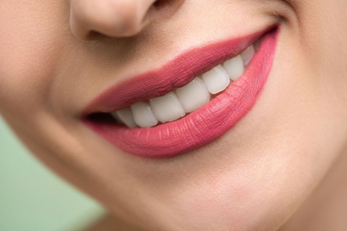 Gros plan sur un sourire apres des soins dentaires
