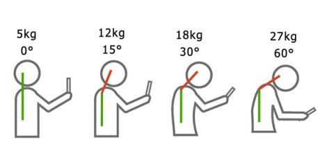 Schéma : la charge sur la nuque passe de 5 kg tête droite à 12, 18 puis 27 kg quand la tête s’incline de 15, 30 puis 60 degrés