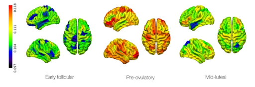 Brain imaging visual showing changes in whole-brain network activity across the menstrual cycle, with greater complexity in the pre-ovulatory phase compared to menstrual and luteal phases.