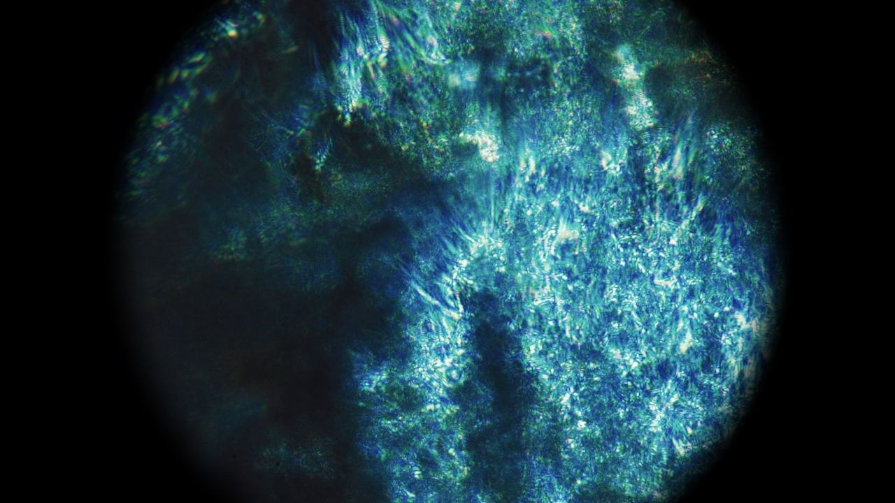The neuroscience of endometriosis
