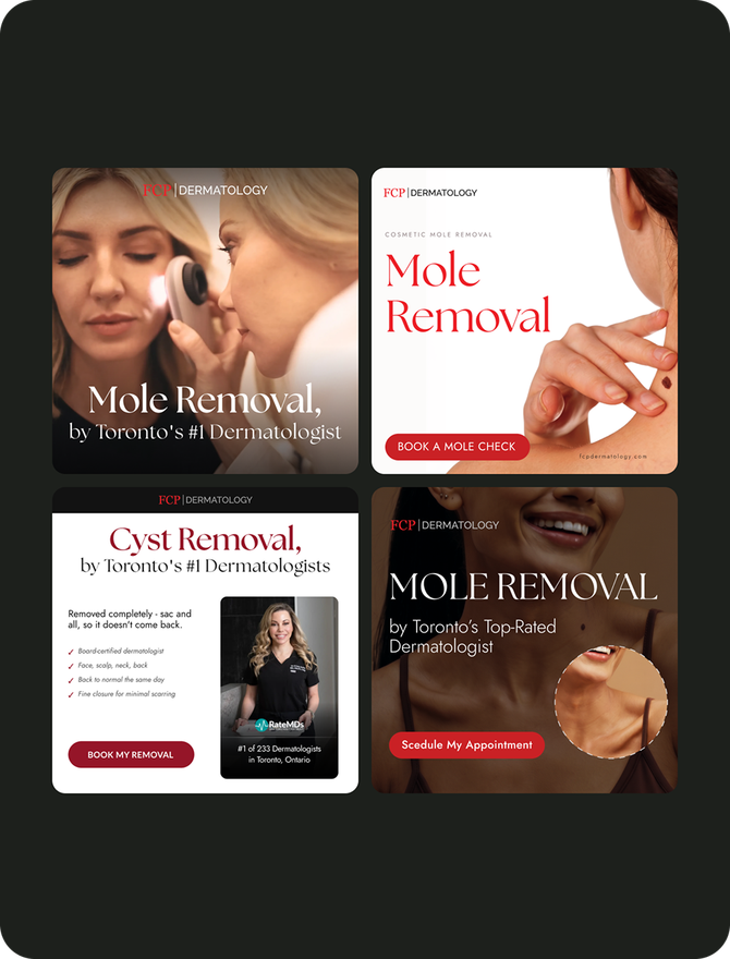Paid ad creatives for FCP Dermatology’s mole removal and cyst removal campaigns