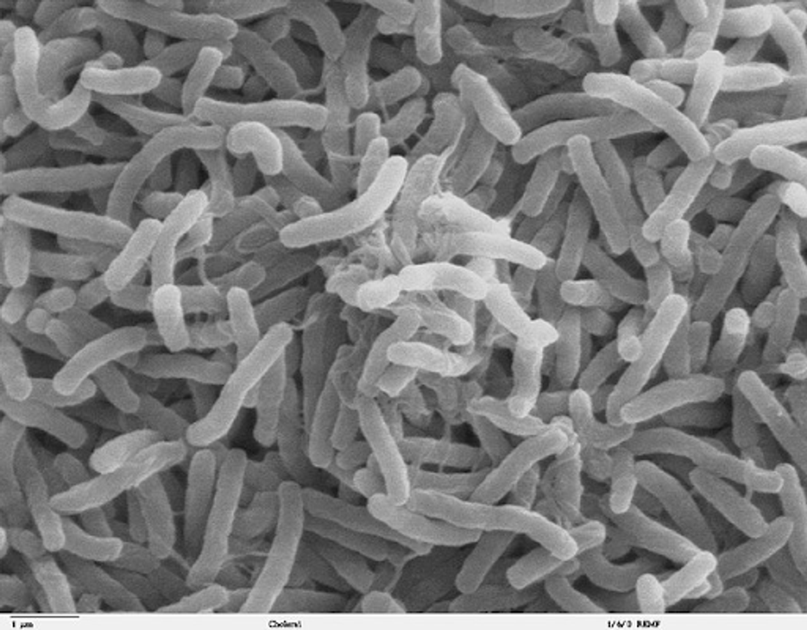 2024 Sees Staggering Rise of Cholera Cases in Africa