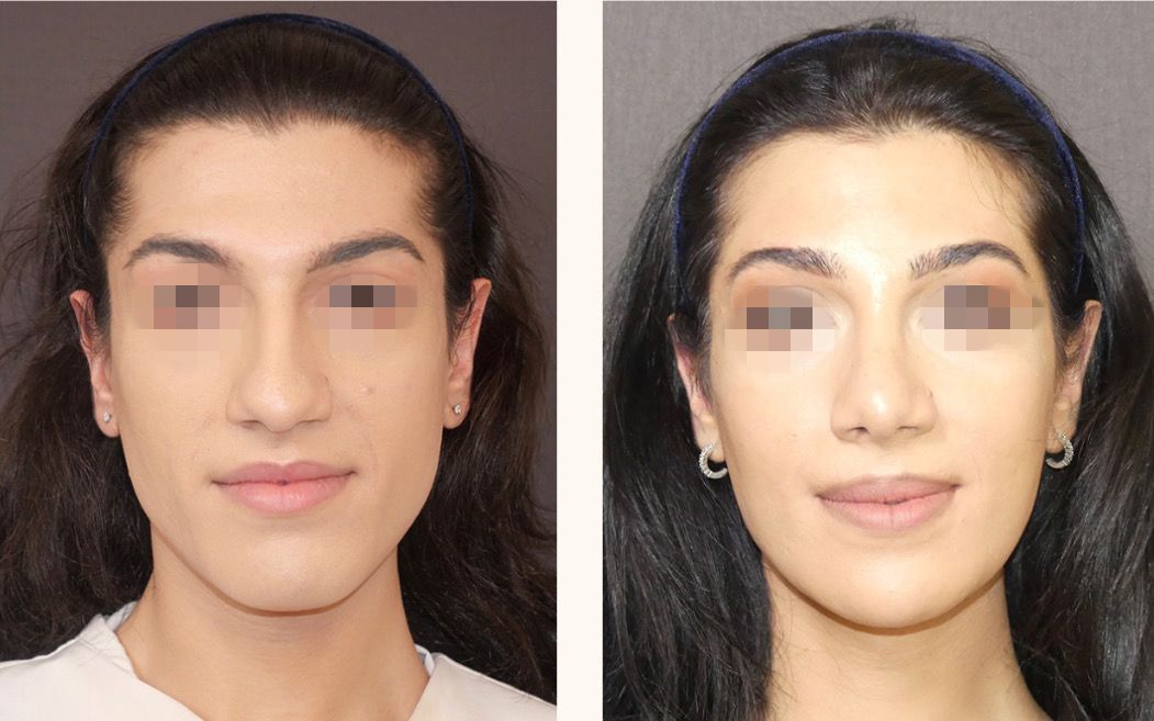 феминизация