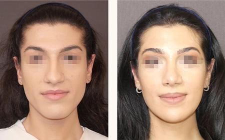 феминизация