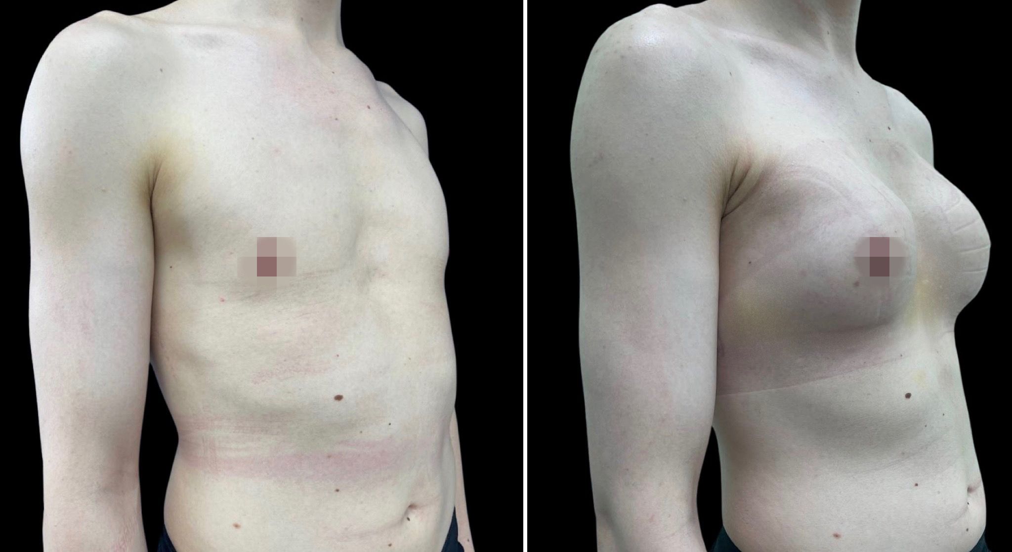 феминизация