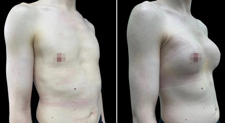 феминизация