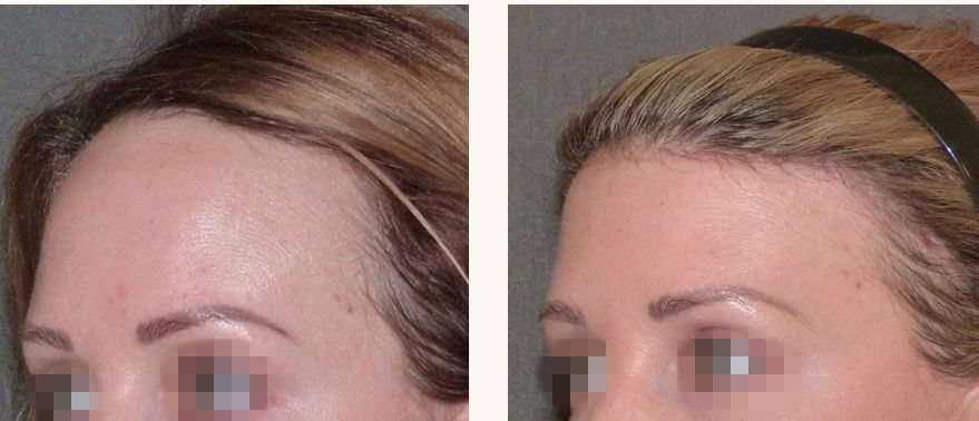 феминизация