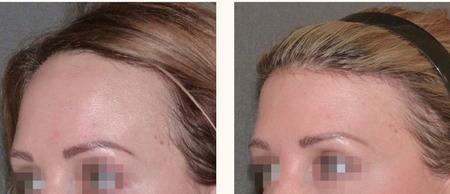 феминизация