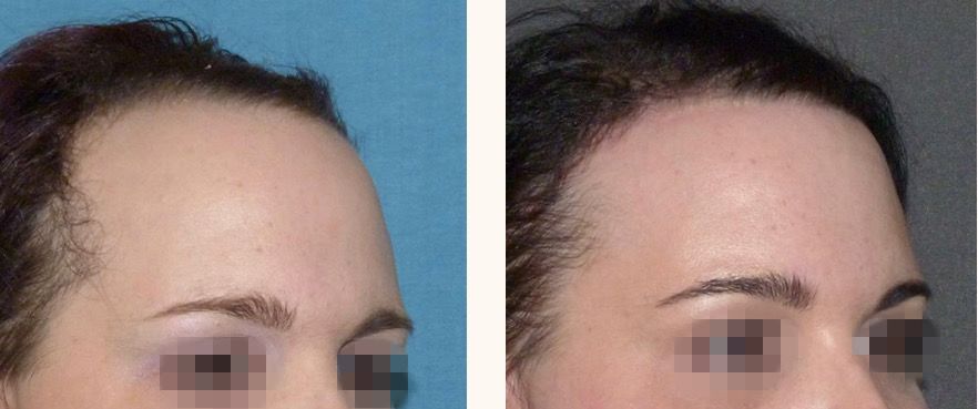 феминизация