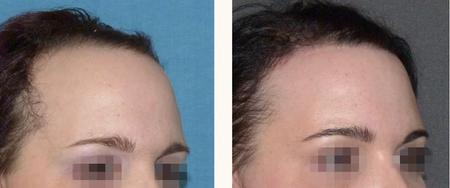 феминизация