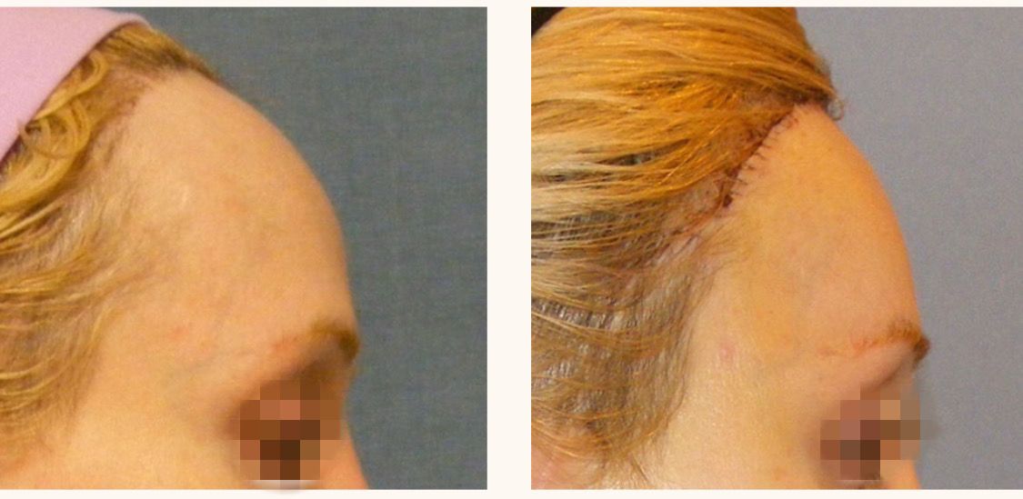 феминизация