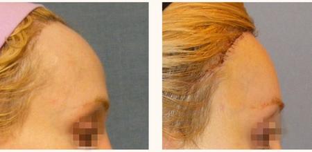 феминизация