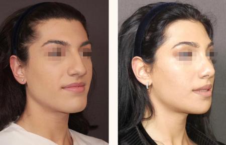 феминизация