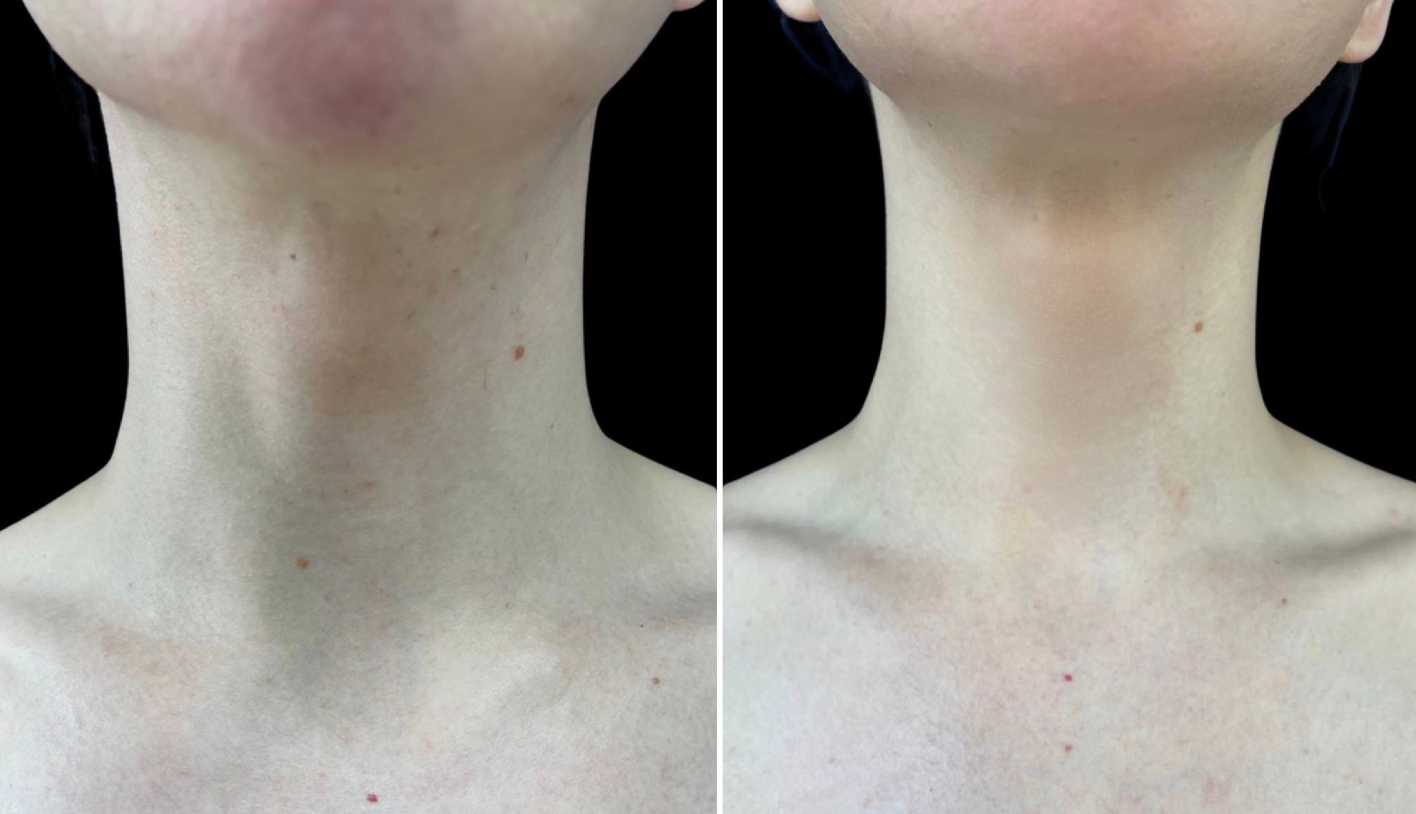 феминизация