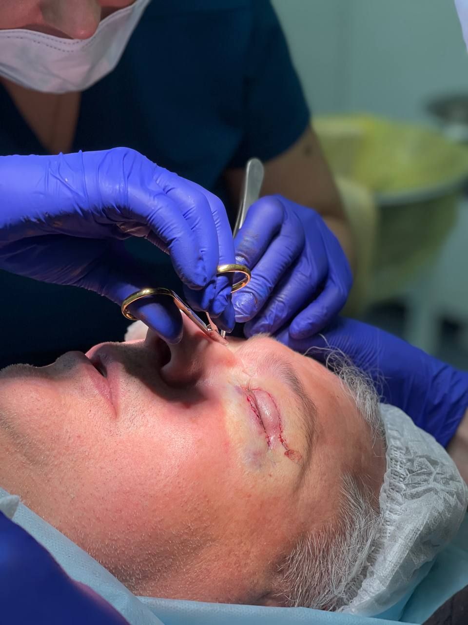 Пластический хирург пластика операции ринопластика липосакция маммопластика увеличение груди липофилинг блефаропластика фейслифтинг подтяжка лица брахиопластика круропластика бодипластика рубцовые деформации реконструкция 