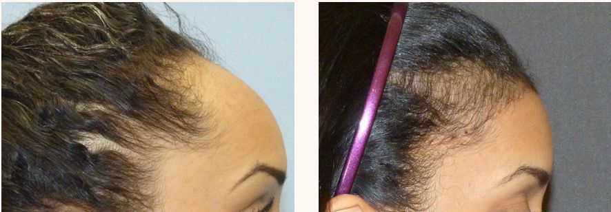 феминизация